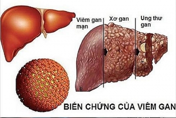 tam soat som ung thu te bao gan