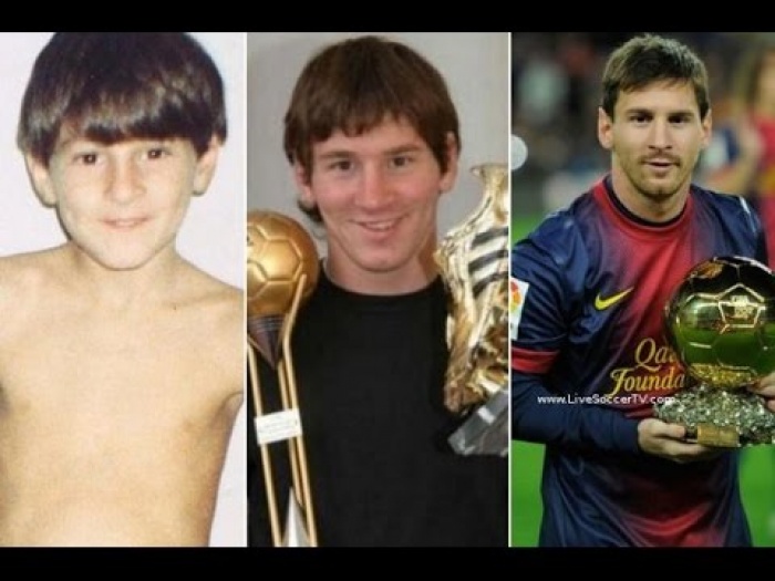 Messi Disease