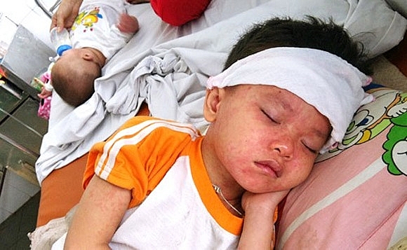 3 dich benh hoanh hanh mua dong xuan